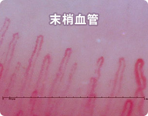 末梢血管